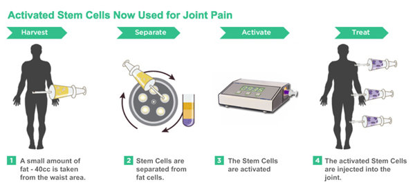 Stem Cell for Bone and Joint - Britannia Medical Center