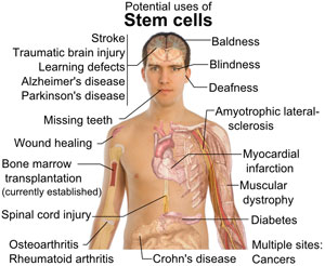Stem Cell Treatment for Organs